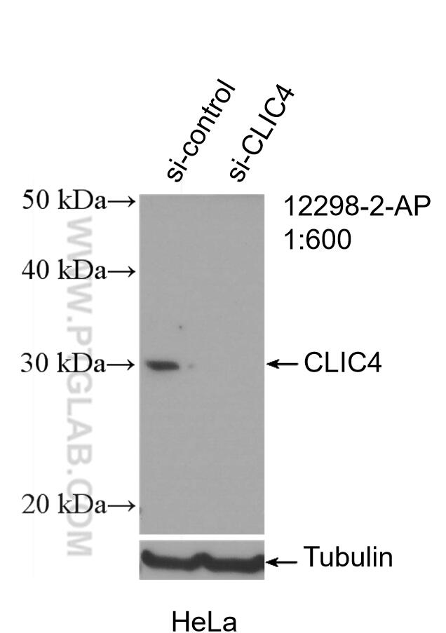 Western Blot (WB) analysis of HeLa cells using CLIC4 Polyclonal antibody (12298-2-AP)