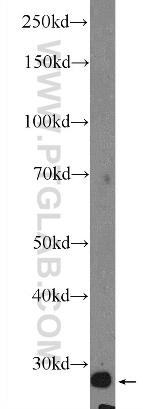 WB analysis of mouse kidney using 12298-2-AP