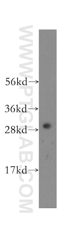 Western Blot (WB) analysis of human kidney tissue using CLIC4 Polyclonal antibody (12298-2-AP)