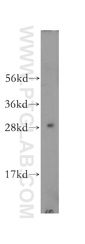 Western Blot (WB) analysis of mouse ovary tissue using CLIC4 Polyclonal antibody (12298-2-AP)