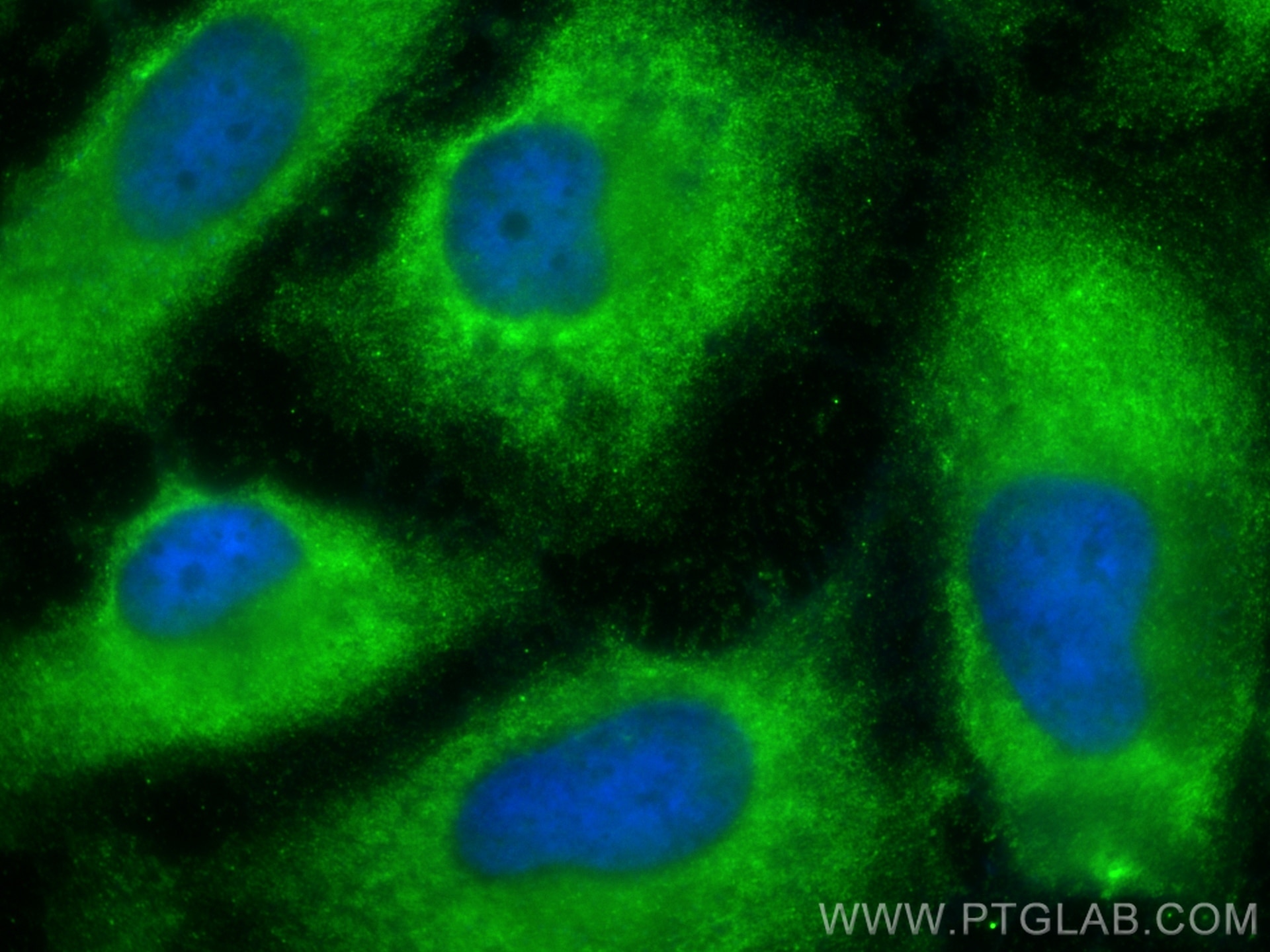 Immunofluorescence (IF) / fluorescent staining of HeLa cells using CLIC4 Monoclonal antibody (66343-1-Ig)