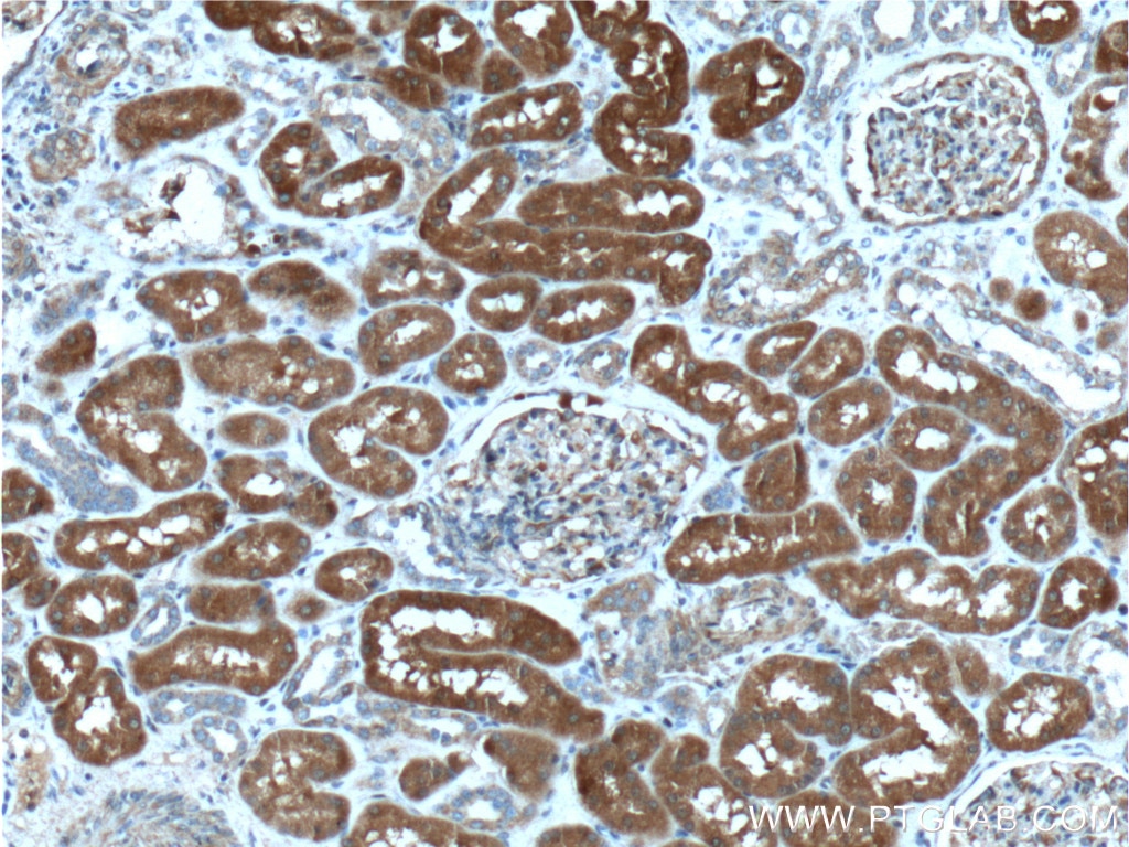 Immunohistochemistry (IHC) staining of human kidney tissue using CLIC4 Monoclonal antibody (66343-1-Ig)
