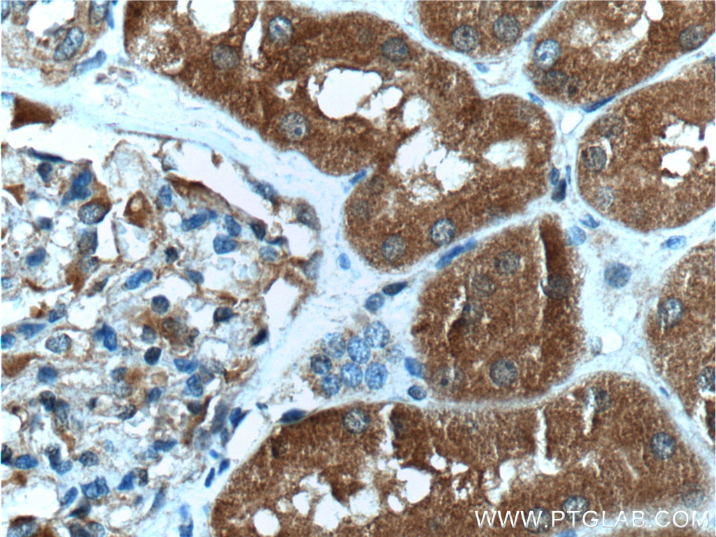 Immunohistochemistry (IHC) staining of human kidney tissue using CLIC4 Monoclonal antibody (66343-1-Ig)