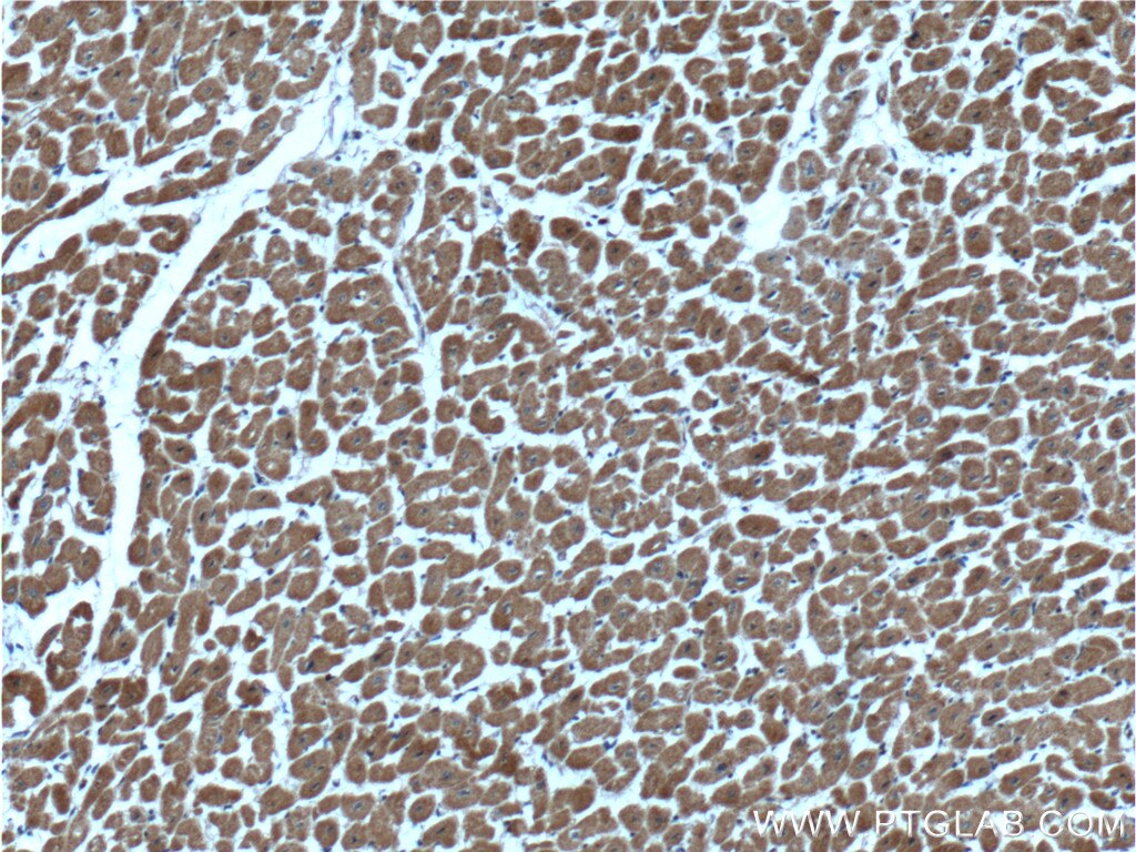 Immunohistochemistry (IHC) staining of human heart tissue using CLIC4 Monoclonal antibody (66343-1-Ig)