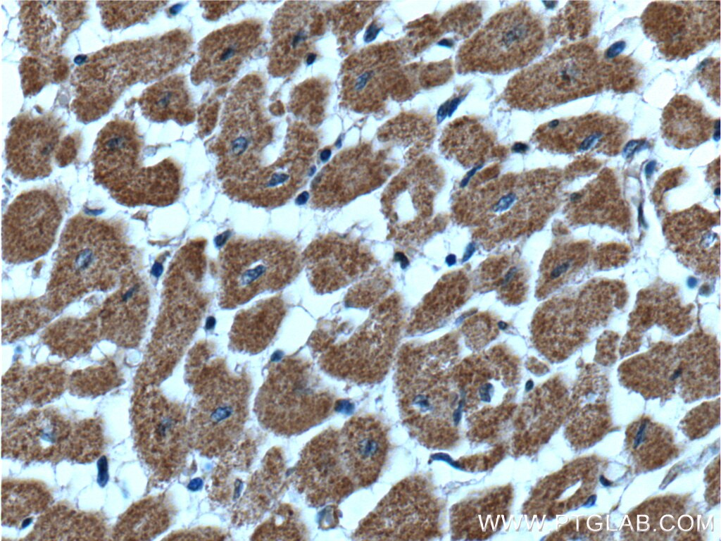 Immunohistochemistry (IHC) staining of human heart tissue using CLIC4 Monoclonal antibody (66343-1-Ig)