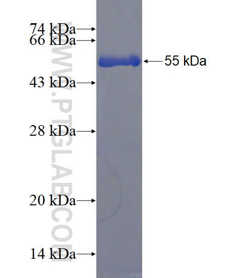 CLIC4 fusion protein Ag2942 SDS-PAGE