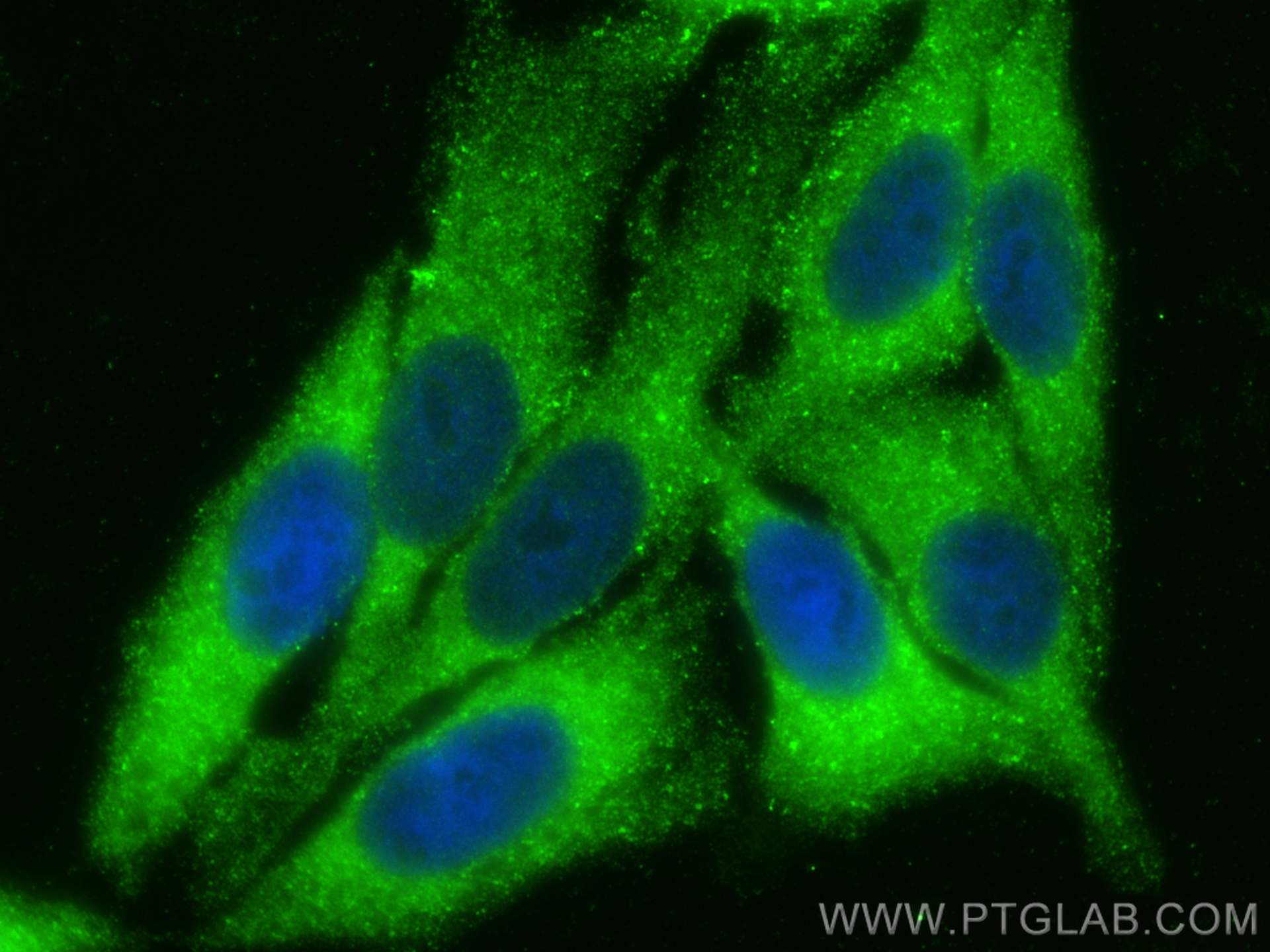 Immunofluorescence (IF) / fluorescent staining of HepG2 cells using CLINT1 Polyclonal antibody (10470-1-AP)