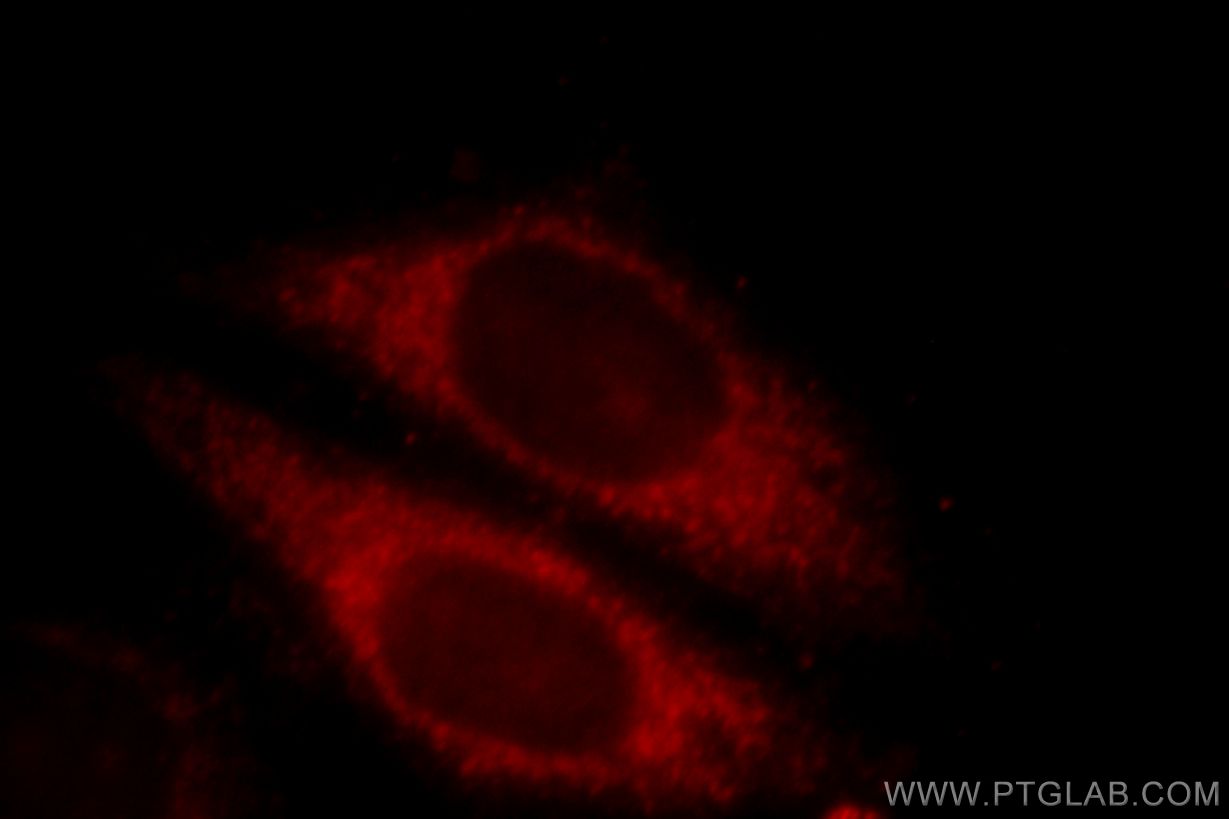Immunofluorescence (IF) / fluorescent staining of HepG2 cells using CLINT1 Polyclonal antibody (10470-1-AP)