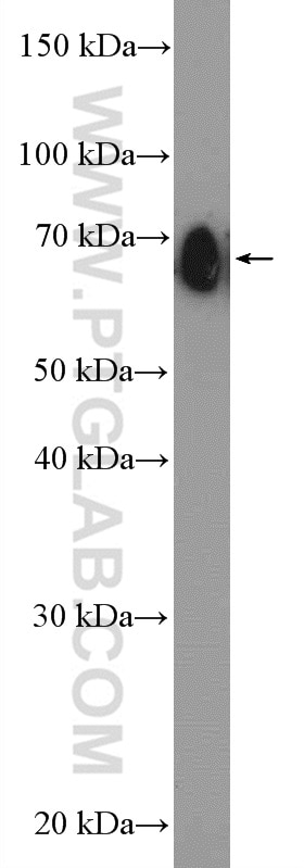 Western Blot (WB) analysis of HepG2 cells using CLINT1 Polyclonal antibody (10470-1-AP)