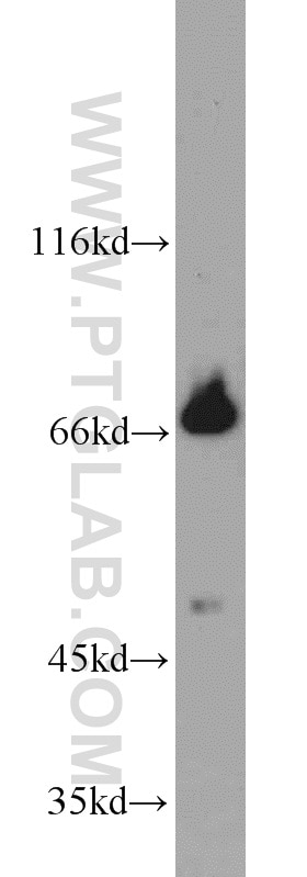 Western Blot (WB) analysis of mouse brain tissue using CLINT1 Polyclonal antibody (10470-1-AP)