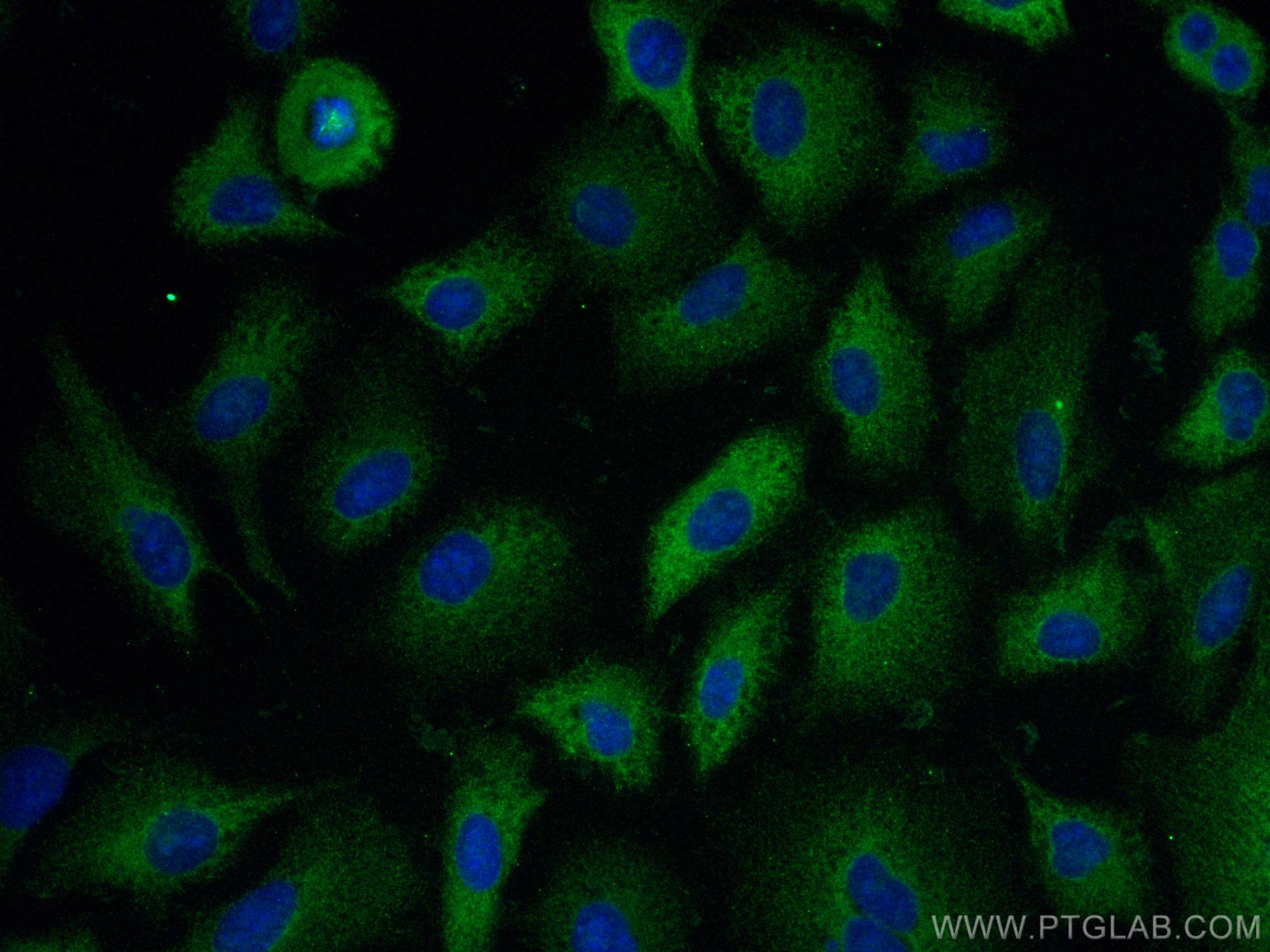Immunofluorescence (IF) / fluorescent staining of A549 cells using CLIP-115/CLIP2 Monoclonal antibody (67776-1-Ig)