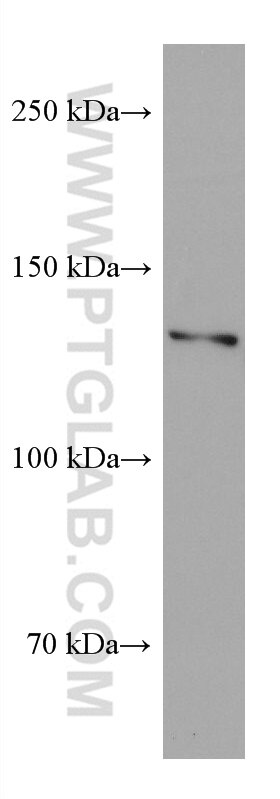 Western Blot (WB) analysis of rabbit brain tissue using CLIP-115/CLIP2 Monoclonal antibody (67776-1-Ig)