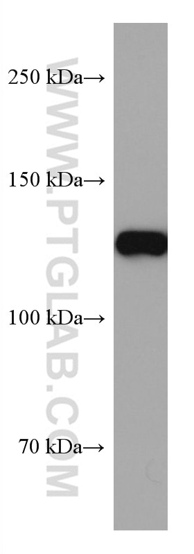 Western Blot (WB) analysis of rat brain tissue using CLIP-115/CLIP2 Monoclonal antibody (67776-1-Ig)