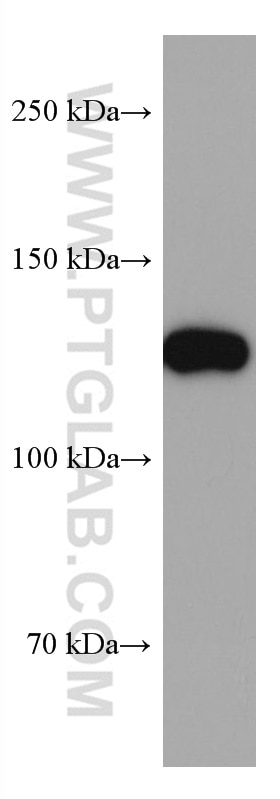 Western Blot (WB) analysis of mouse brain tissue using CLIP-115/CLIP2 Monoclonal antibody (67776-1-Ig)