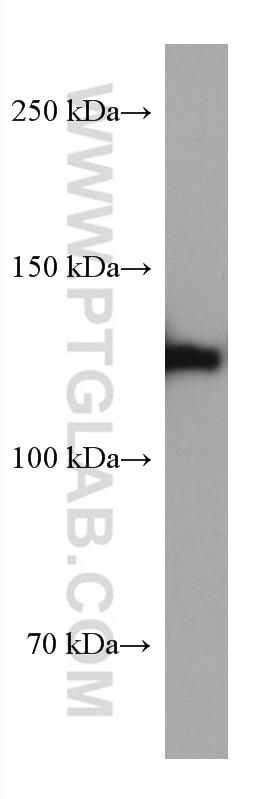 Western Blot (WB) analysis of pig cerebellum tissue using CLIP-115/CLIP2 Monoclonal antibody (67776-1-Ig)