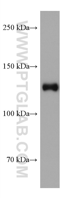 Western Blot (WB) analysis of rat cerebellum tissue using CLIP-115/CLIP2 Monoclonal antibody (67776-1-Ig)