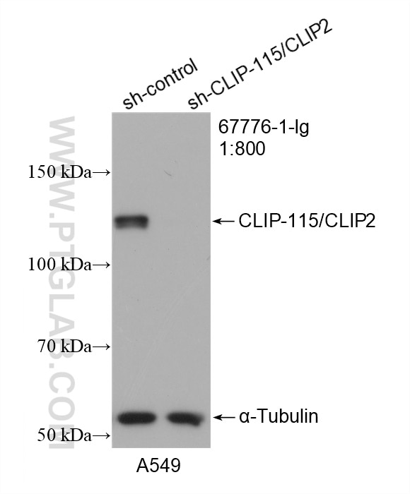 Western Blot (WB) analysis of A549 cells using CLIP-115/CLIP2 Monoclonal antibody (67776-1-Ig)