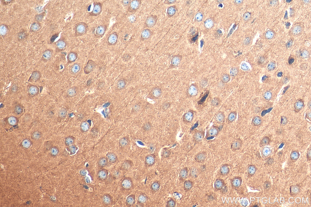 Immunohistochemistry (IHC) staining of mouse brain tissue using CLIP-115/CLIP2 Polyclonal antibody (25088-1-AP)