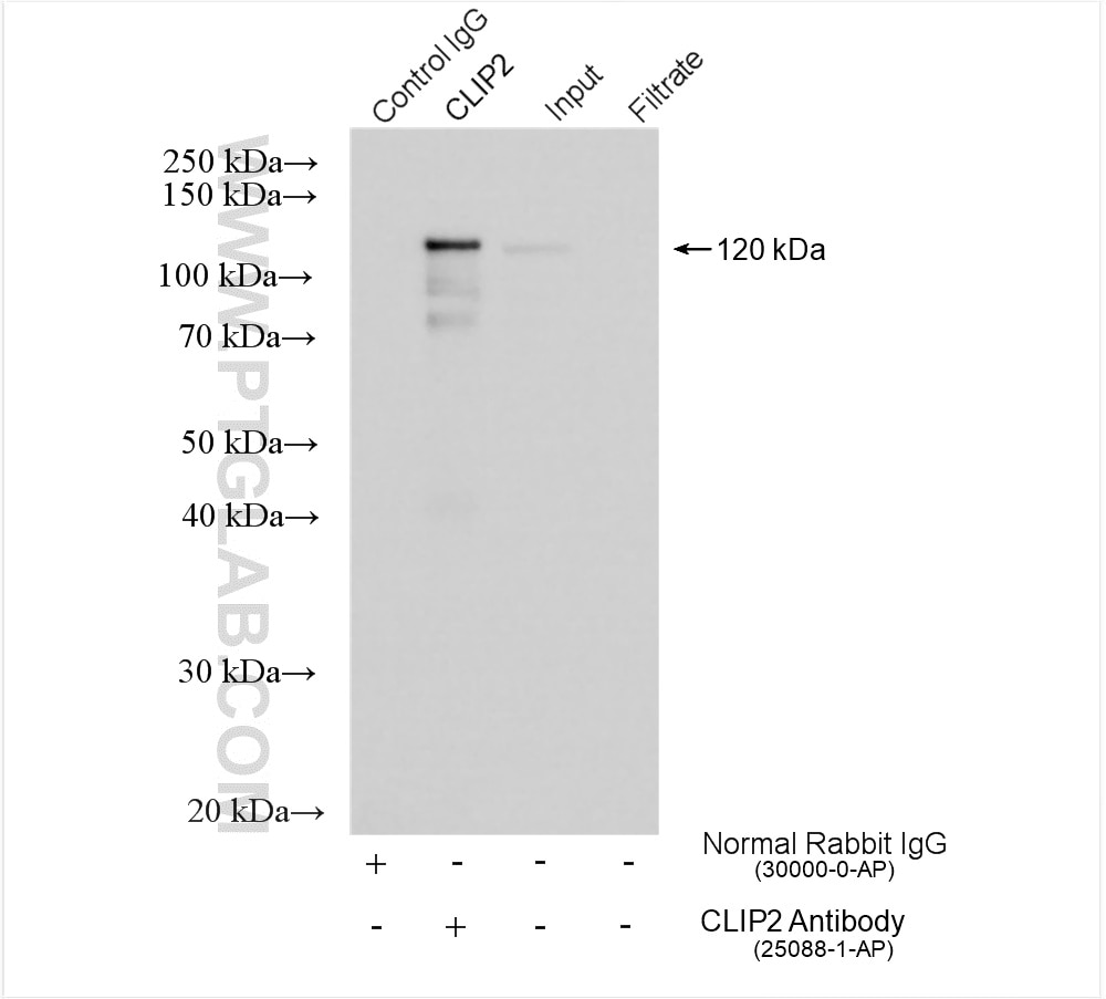 Immunoprecipitation (IP) experiment of mouse brain tissue using CLIP-115/CLIP2 Polyclonal antibody (25088-1-AP)