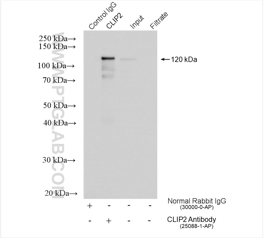 IP experiment of mouse brain using 25088-1-AP