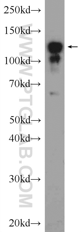 Western Blot (WB) analysis of rat brain tissue using CLIP-115/CLIP2 Polyclonal antibody (25088-1-AP)