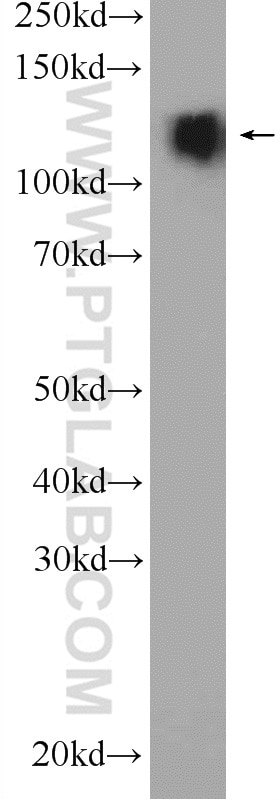 Western Blot (WB) analysis of mouse brain tissue using CLIP-115/CLIP2 Polyclonal antibody (25088-1-AP)