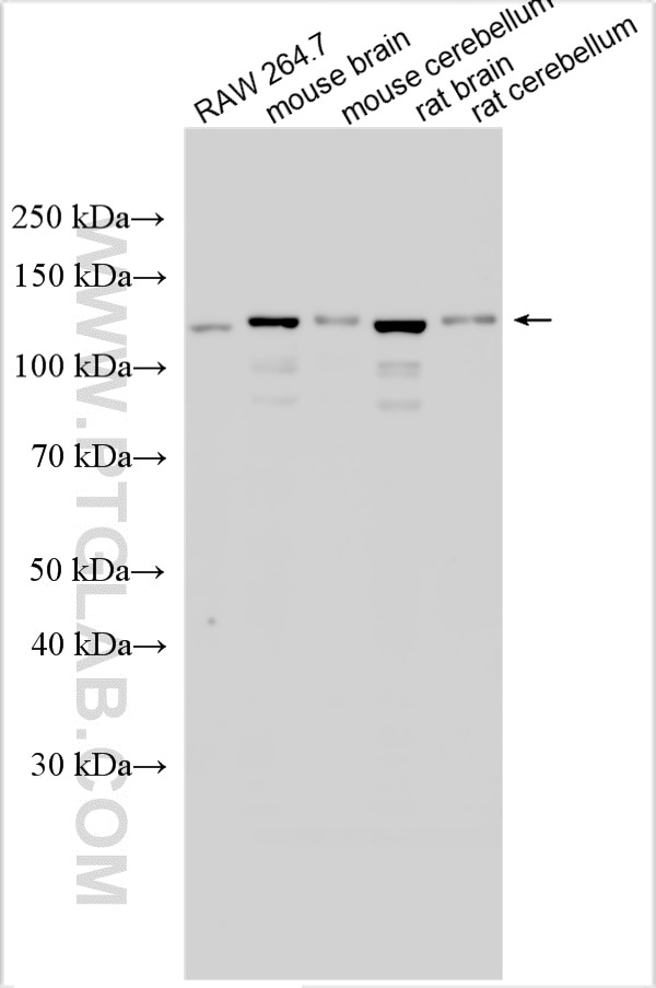 Western Blot (WB) analysis of various lysates using CLIP-115/CLIP2 Polyclonal antibody (25088-1-AP)
