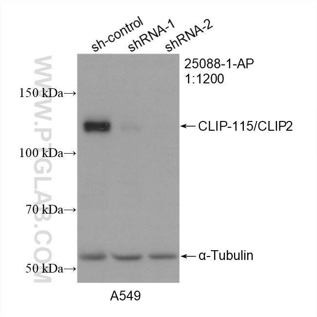 Western Blot (WB) analysis of A549 cells using CLIP-115/CLIP2 Polyclonal antibody (25088-1-AP)