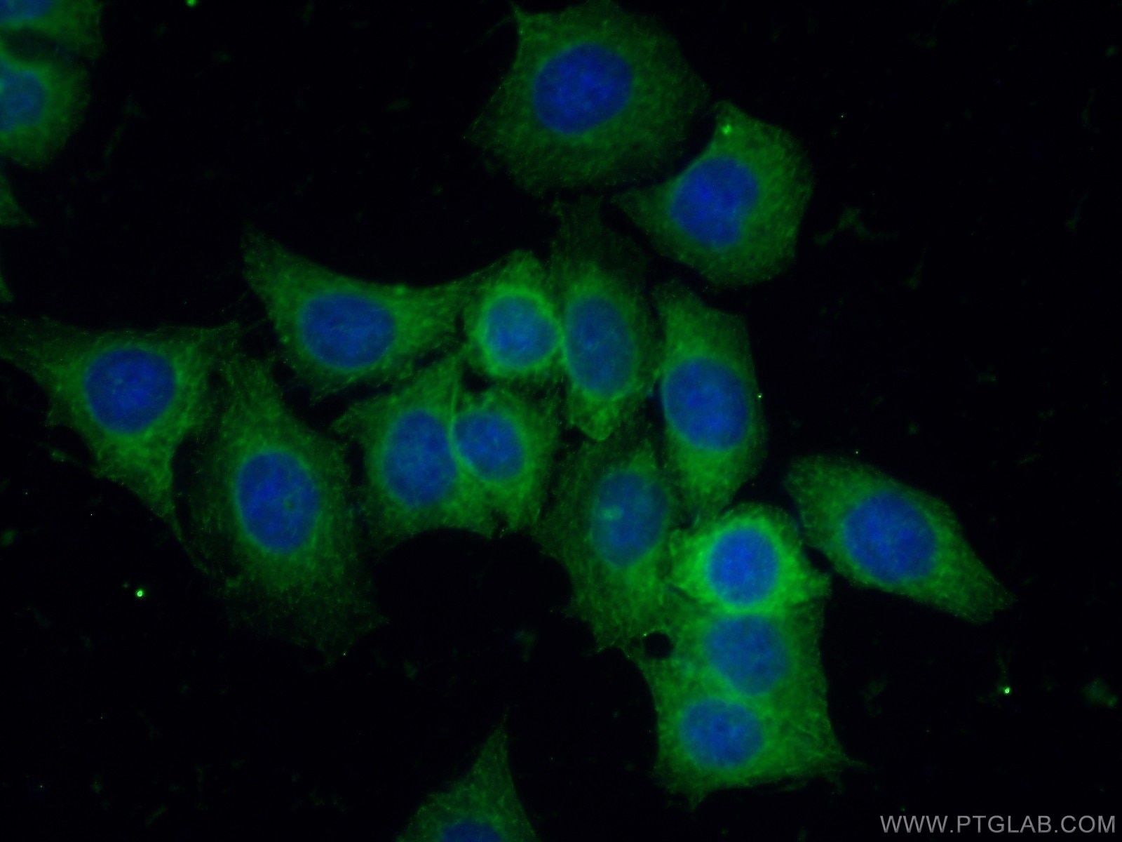 Immunofluorescence (IF) / fluorescent staining of HeLa cells using CLIP1 Polyclonal antibody (23839-1-AP)