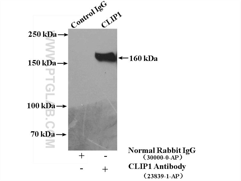 Immunoprecipitation (IP) experiment of HeLa cells using CLIP1 Polyclonal antibody (23839-1-AP)