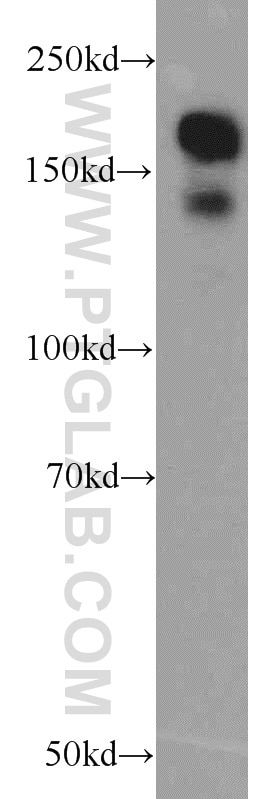 Western Blot (WB) analysis of MCF-7 cells using CLIP1 Polyclonal antibody (23839-1-AP)