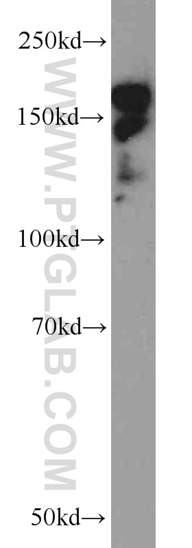 Western Blot (WB) analysis of U-937 cells using CLIP1 Polyclonal antibody (23839-1-AP)