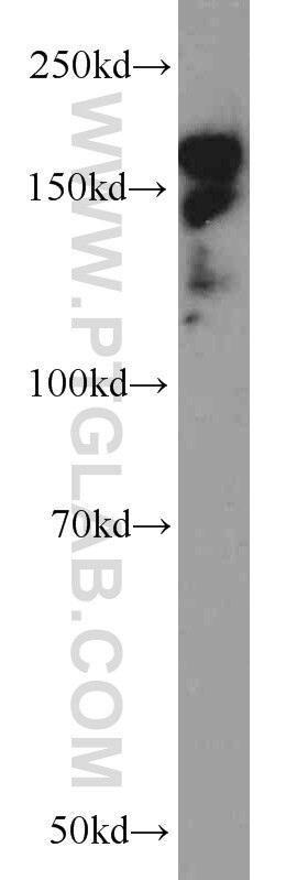 Western Blot (WB) analysis of U-937 cells using CLIP1 Polyclonal antibody (23839-1-AP)