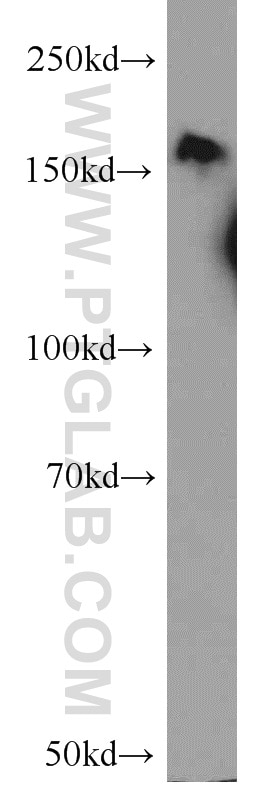 Western Blot (WB) analysis of HEK-293 cells using CLIP1 Polyclonal antibody (23839-1-AP)