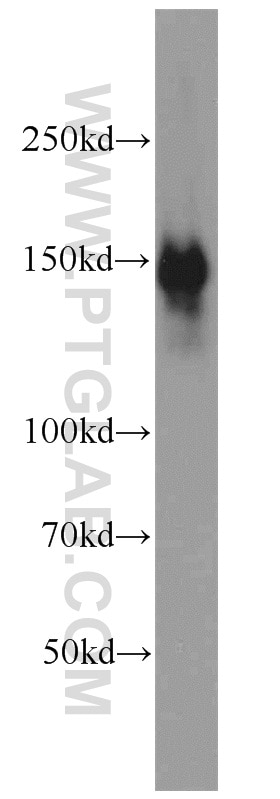 Western Blot (WB) analysis of HEK-293 cells using CLIP1 Polyclonal antibody (23839-1-AP)