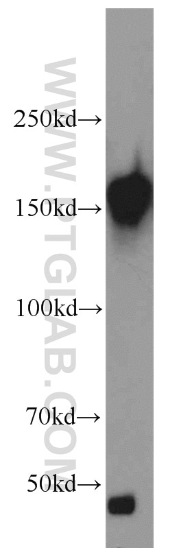 Western Blot (WB) analysis of HeLa cells using CLIP1 Polyclonal antibody (23839-1-AP)