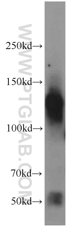 Western Blot (WB) analysis of rat kidney tissue using CLIP1 Polyclonal antibody (23839-1-AP)