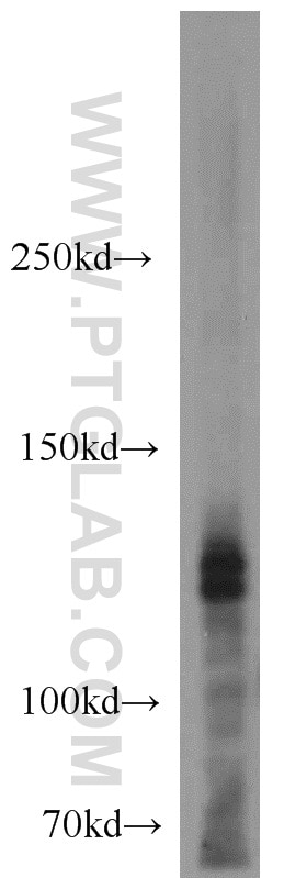 Western Blot (WB) analysis of mouse kidney tissue using CLIP1 Polyclonal antibody (23839-1-AP)