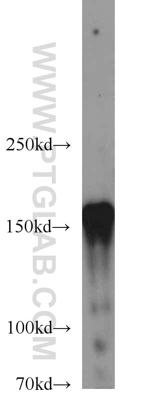 Western Blot (WB) analysis of HeLa cells using CLIP1 Polyclonal antibody (23839-1-AP)