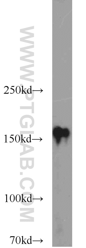 Western Blot (WB) analysis of HEK-293 cells using CLIP1 Polyclonal antibody (23839-1-AP)