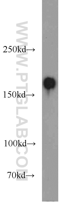Western Blot (WB) analysis of MCF-7 cells using CLIP1 Polyclonal antibody (23839-1-AP)