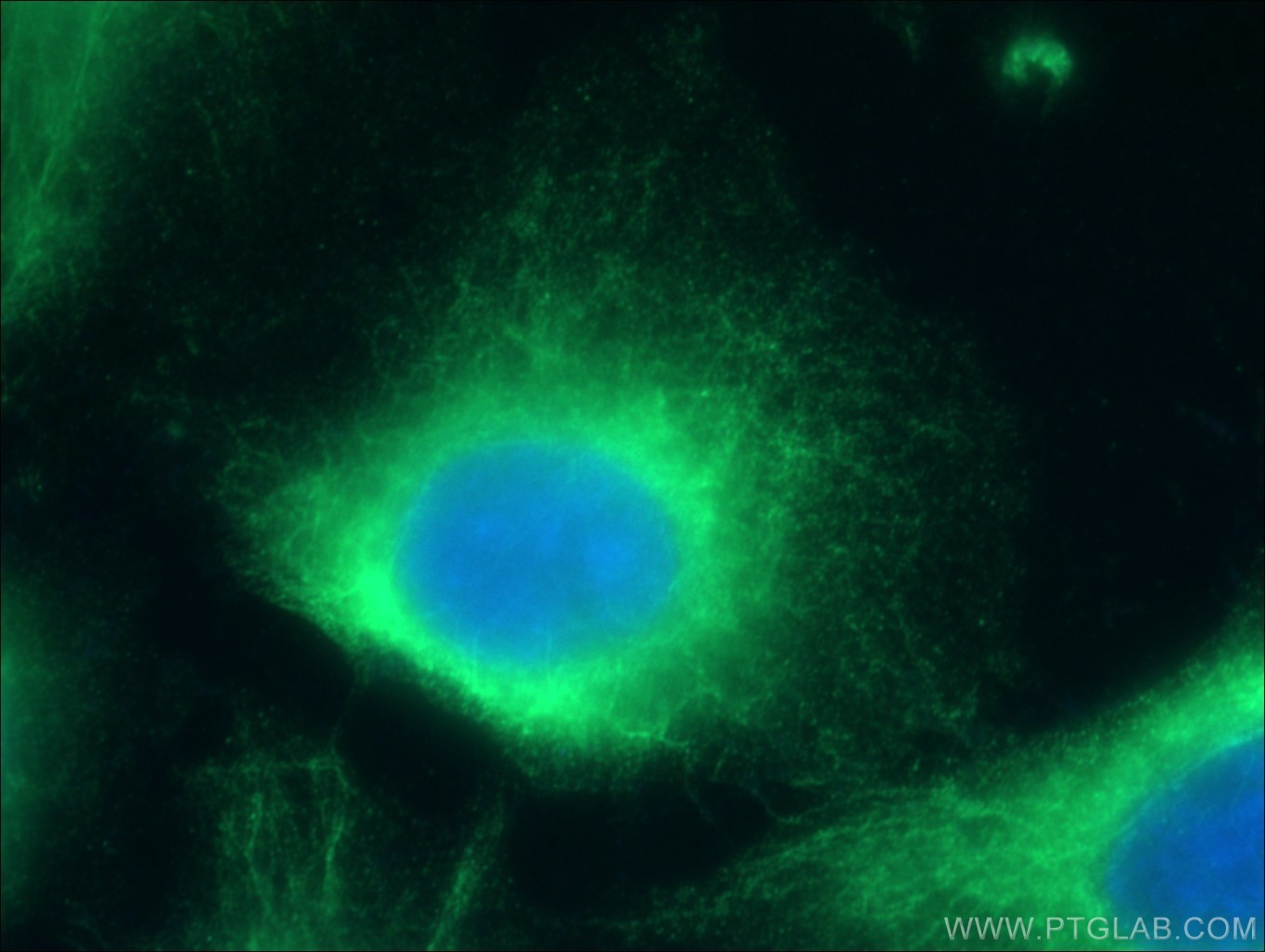 Immunofluorescence (IF) / fluorescent staining of HUVEC cells using CLIP4 Polyclonal antibody (17044-1-AP)