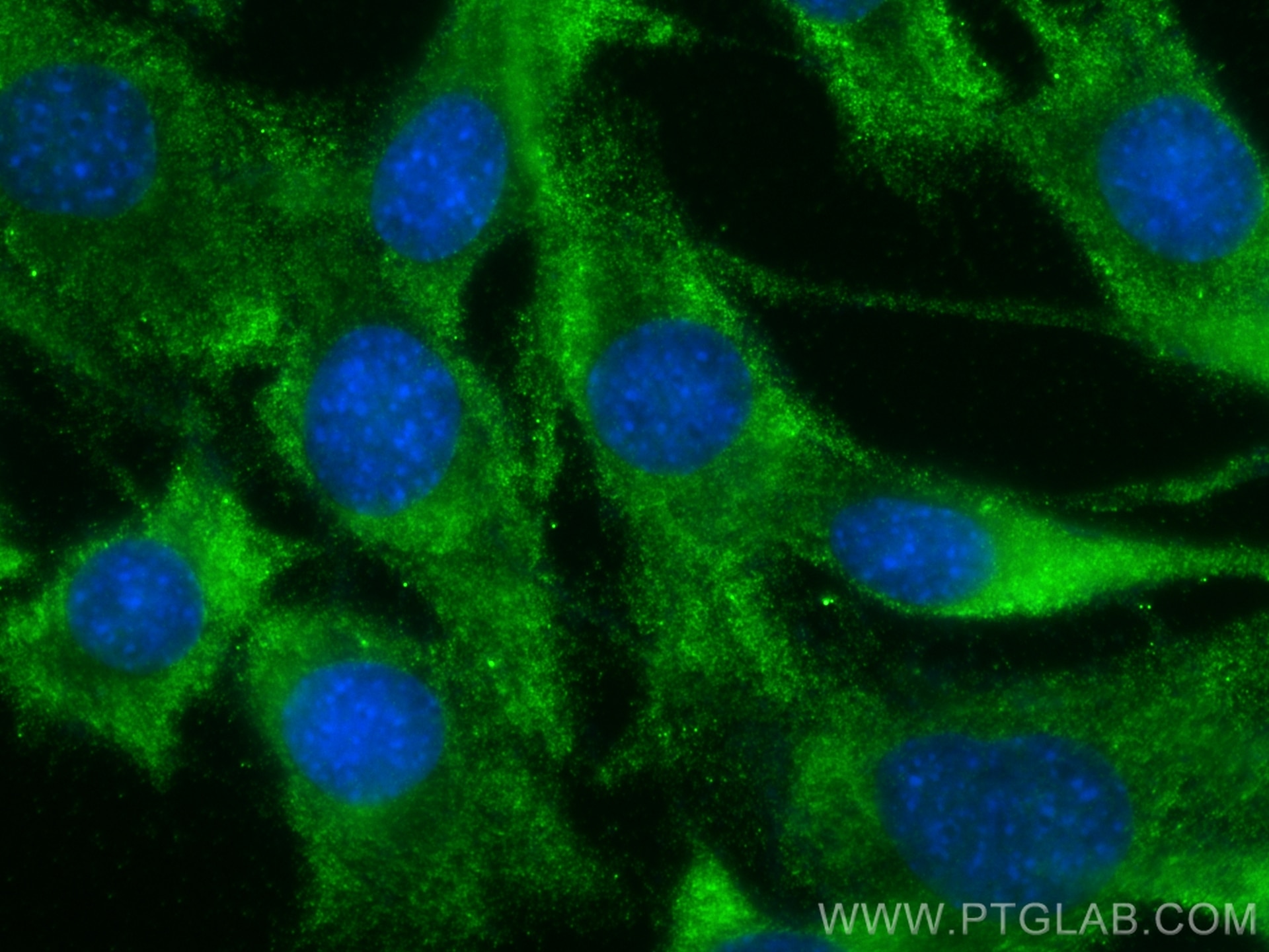 Immunofluorescence (IF) / fluorescent staining of C2C12 cells using CLIP4 Polyclonal antibody (17044-1-AP)