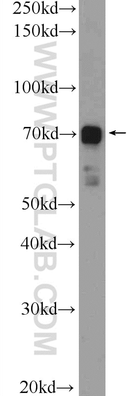 Western Blot (WB) analysis of HUVEC cells using CLIP4 Polyclonal antibody (17044-1-AP)