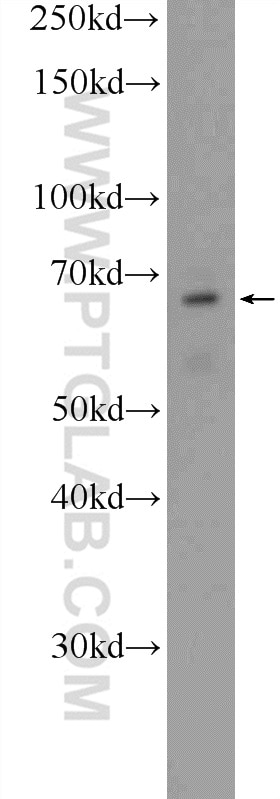 Western Blot (WB) analysis of Y79 cells using CLIP4 Polyclonal antibody (17044-1-AP)