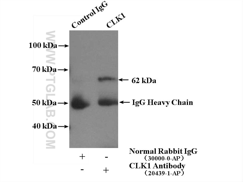Immunoprecipitation (IP) experiment of COLO 320 cells using CLK1 Polyclonal antibody (20439-1-AP)