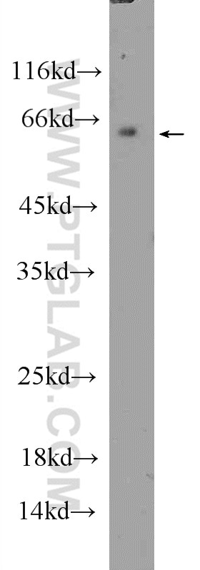 Western Blot (WB) analysis of HepG2 cells using CLK1 Polyclonal antibody (20439-1-AP)