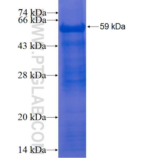 CLK2 fusion protein Ag1549 SDS-PAGE