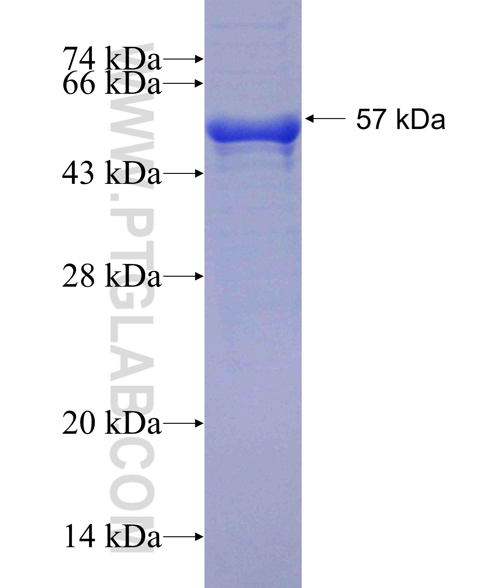 CLK2 fusion protein Ag1549 SDS-PAGE