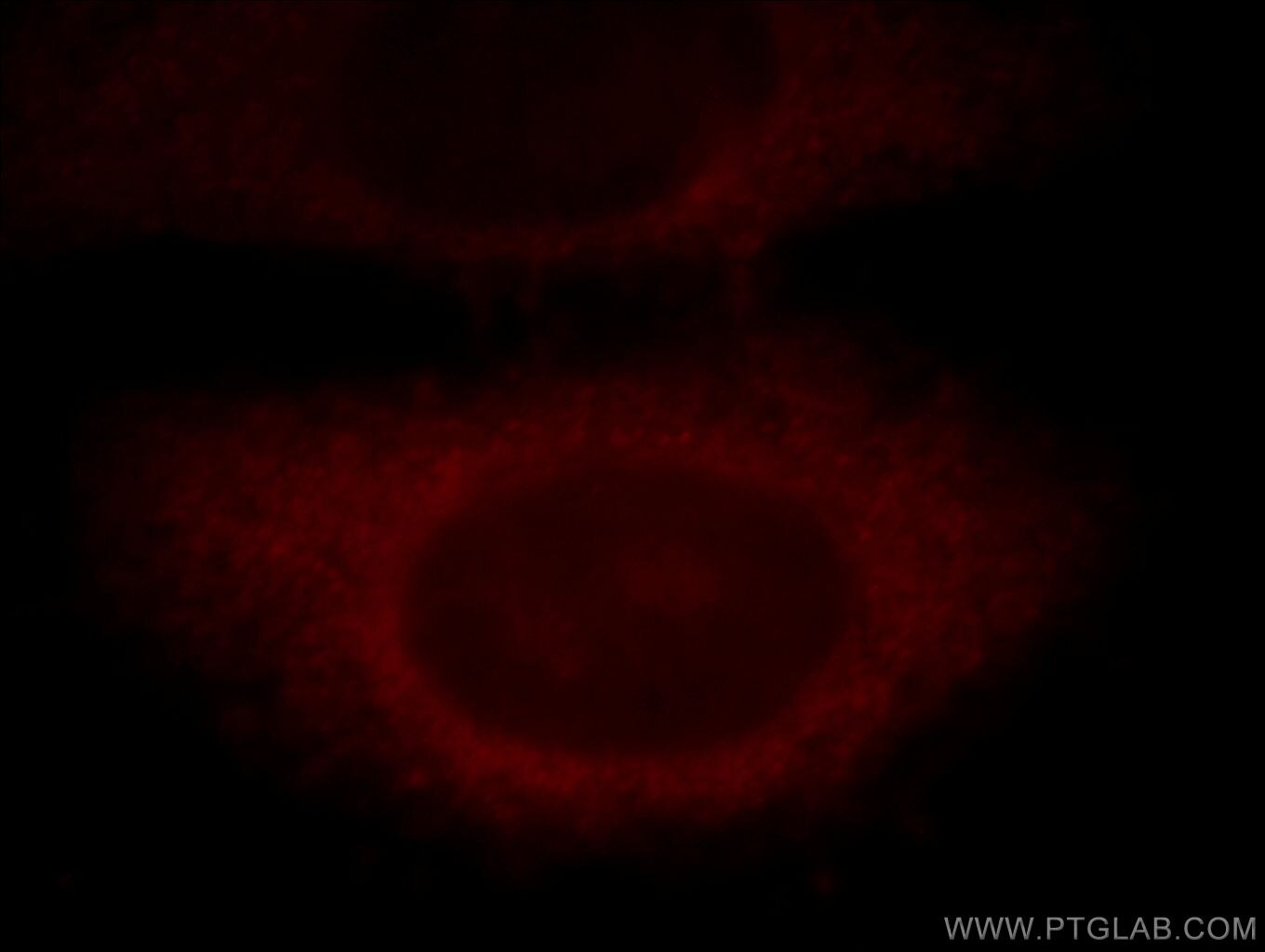 Immunofluorescence (IF) / fluorescent staining of HepG2 cells using CLN3 Polyclonal antibody (20386-1-AP)